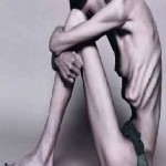 Aneroxia : Diet Maut