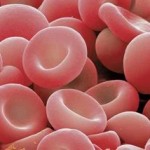 TALASEMIA: Penyakit Genetik Yang Membawa Maut