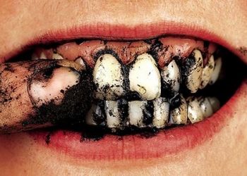 Arang Aktif (activated charcoal) dan Pemutihan Gigi