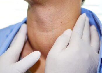 Bengkak Tiroid : Perlukah Di Buang ?