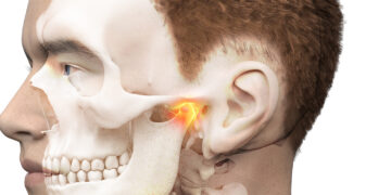 Rahang Berbunyi ‘Klik’? Mungkin Itu Petanda Temporomandibular Disorder (TMD)