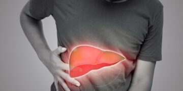 Penyakit Hati Berlemak: Epidemik Senyap di Malaysia