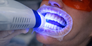 Mengapa Gigi Berubah Warna? Sains di Sebalik Perubahan Warna Gigi dan Cara Menguruskannya