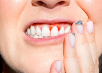 Penyakit Gusi dan Diabetes: Hubungan Tersembunyi Dua Hala