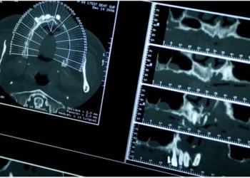 Menembusi Sempadan Mikroskopik: Teknologi Mikro-CT dalam Revolusi Sains Moden