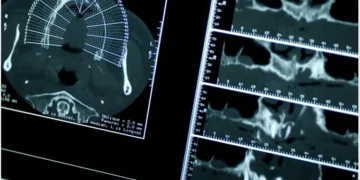 Menembusi Sempadan Mikroskopik: Teknologi Mikro-CT dalam Revolusi Sains Moden