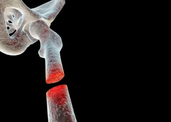 Inovasi Baharu Tulang Tiruan Menggunakan Teknologi Bioseramik Berkos Rendah