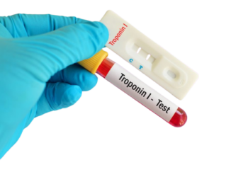 Ujian Troponin: Penanda Kecederaan Jantung