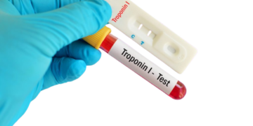 Ujian Troponin: Penanda Kecederaan Jantung