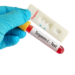 Ujian Troponin: Penanda Kecederaan Jantung