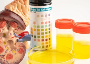 Analisis Urin sebagai Komponen Penting dalam Penilaian Kesihatan